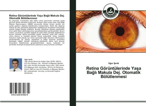 U¿ur ¿Evik | Retina Görüntülerinde Ya¿a Ba¿l¿ Makula Dej. Otomatik Bölütlenmesi