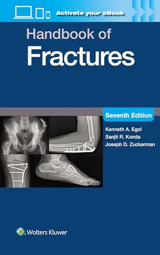 Handbook of Fractures: Mit Online-Dateien - Chirurgie: Umfassendes Nachschlagewerk mit aktuellen Informationen und Online-Zugang zu zusätzlichen Ressourcen.