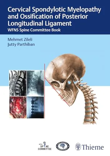 Cervical Spondylotic Myelopathy und Ossifikation des hinteren Längsbandes: WFNS Wirbelsäulenkomitee Buch - Neurochirurgie, umfassende Expertise zu Diagnostik und Therapie von Spondylotischen Erkrankungen der Halswirbelsäule.