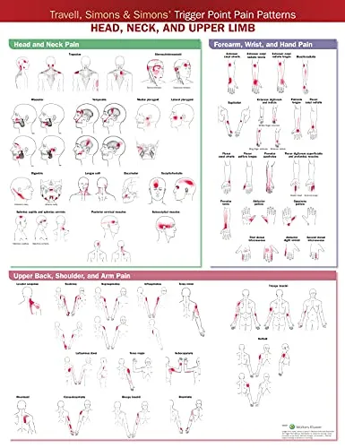 Travell, Simons & Simons Trigger Point Pain Patterns Wall Chart: Head, Neck, and Upper Limb