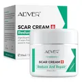 P-Beauty Narbencreme 50ml - Narbengel & Narbensalbe für Gesicht & Körper aus Pflanzenextrakten & pflegenden Ölen - Narbenpflege OP Narben, Aknenarben, Dehnungsstreifen - Narben Reduktion Creme