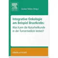 Urban & Fischer Integrative Onkologie am Beispiel Brustkrebs (Deutsch) (7321109)