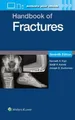 KENNETH A. EGOL Handbook of Fractures: Print + eBook w (Taschenbuch) (US IMPORT)