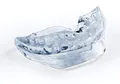 Snorban, einteilige Anti-Schnarch-Schiene, Schnarchstopper für einen erholsamen Schlaf im FlexPoint Set mit handlichem Schlaftipp-ABC