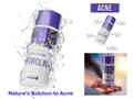 Lavender water with anti-acne effect -150 ml, 100% Organic Natural Product INA