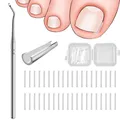 40 Pcs Eingewachsene Zehennägel Set Zehennagel Korrektur Zehennagel Korrektur...
